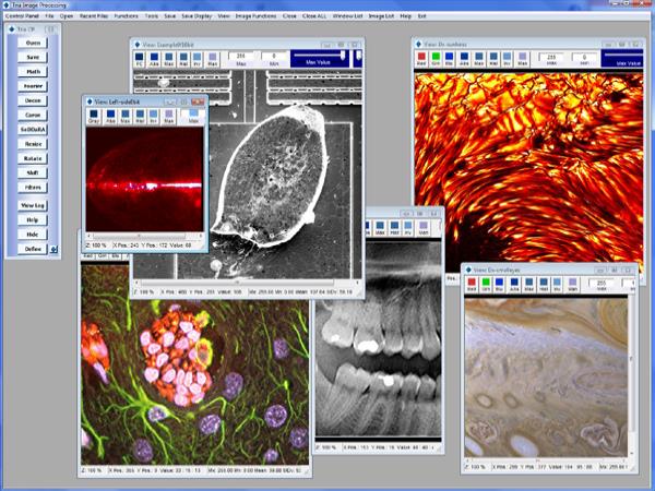 medicalimaging